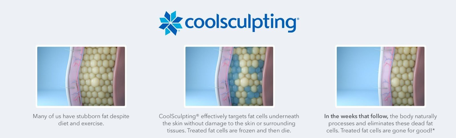 Natural Body Sculpting (Cryotherapy & Woodsculpt) - Safe Haven