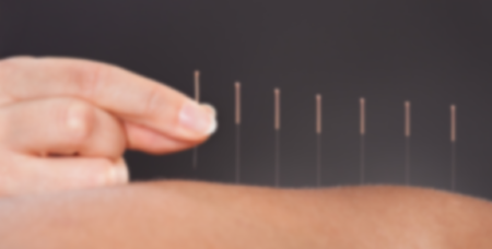 Acupuncture.png