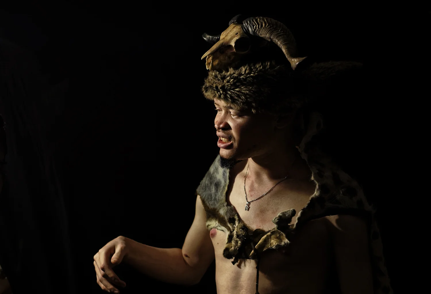 Kenya Albino Beauty Pageant