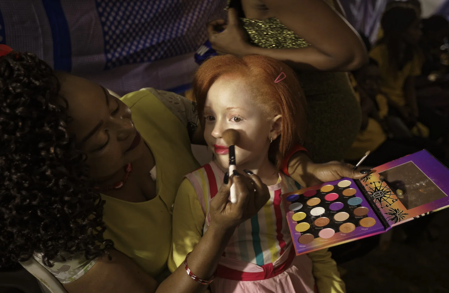 Kenya Albino Beauty Pageant