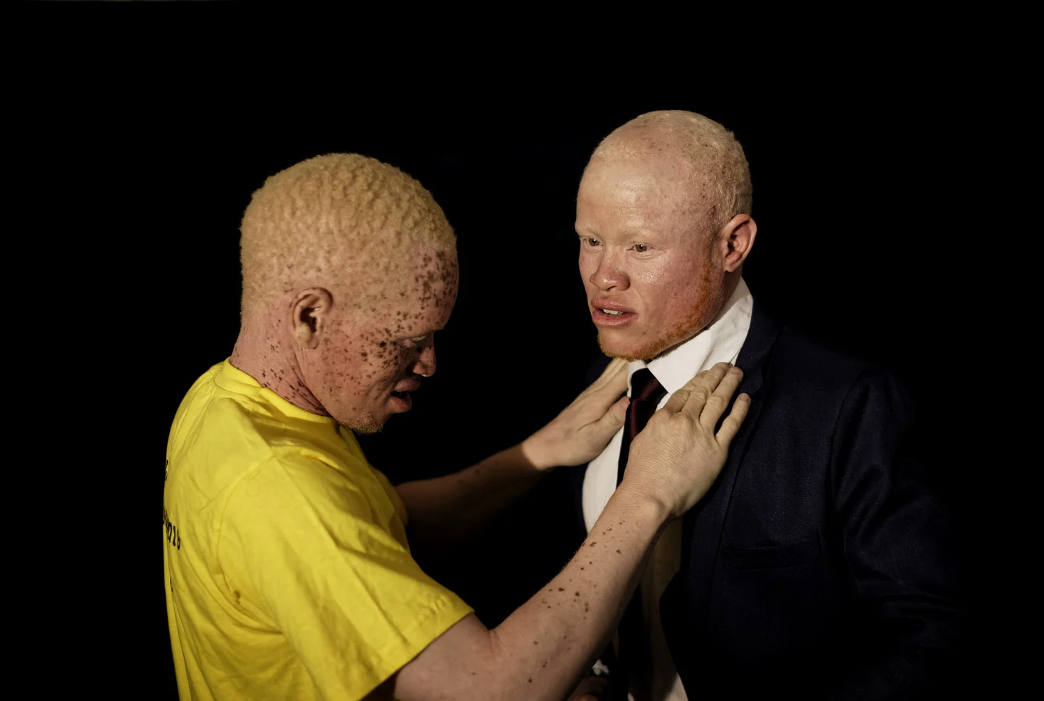 Kenya Albino Beauty Pageant