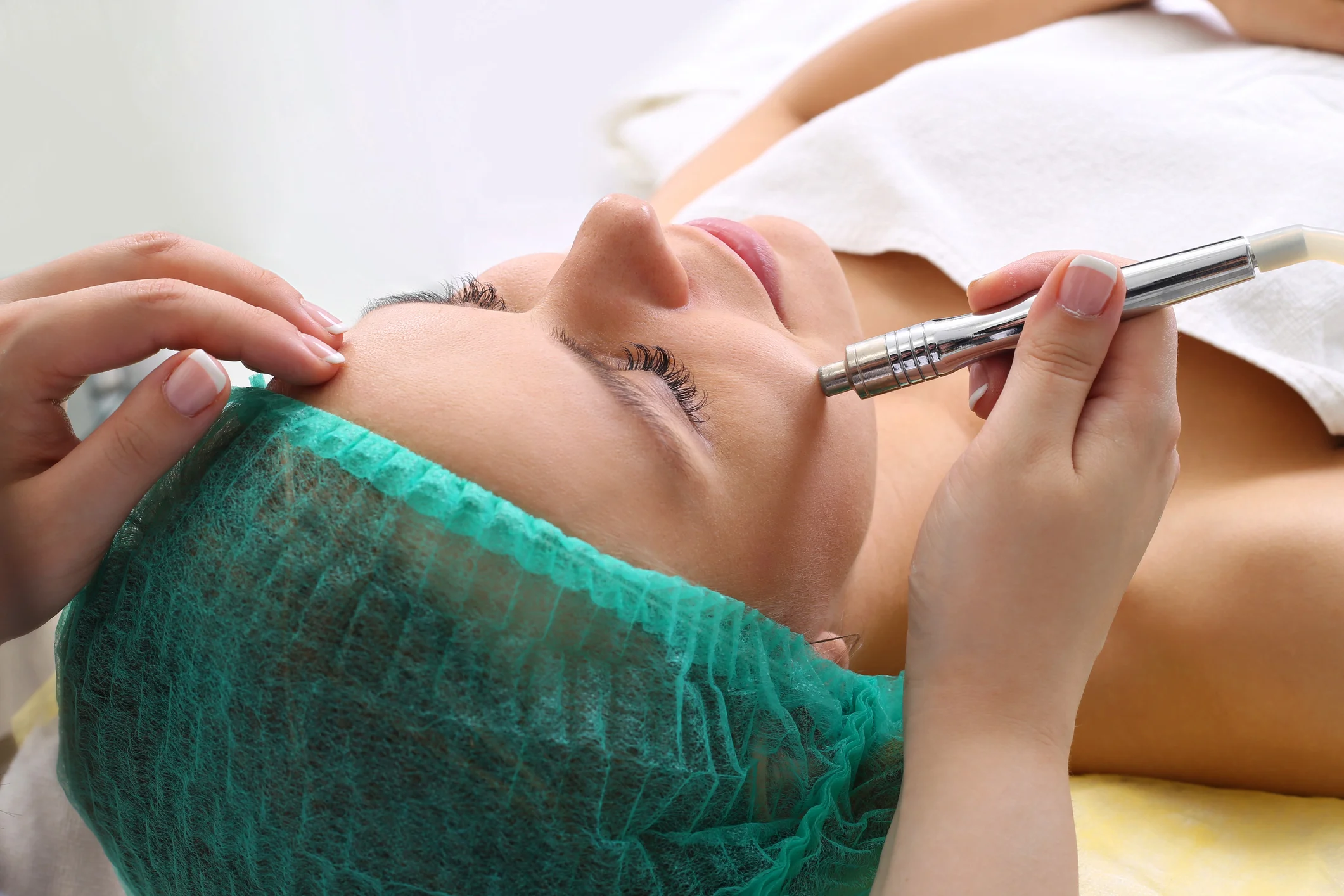 procedure-of-microdermabrasion-75285934.jpg