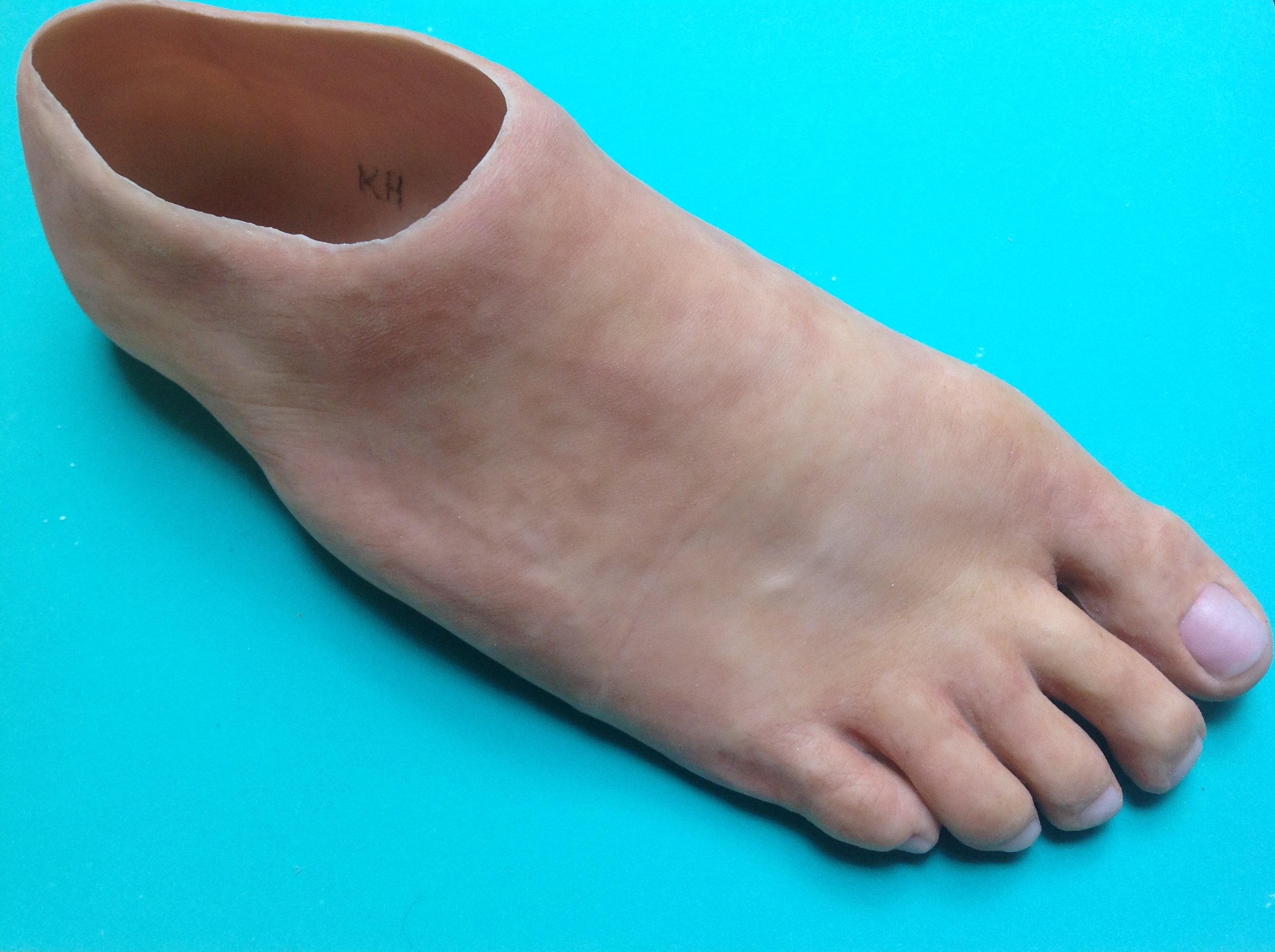 Full Foot Prosthesis