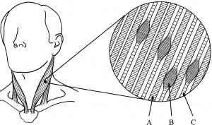 https://sbrsport.files.wordpress.com/2012/09/trigger-point.jpg?w=640