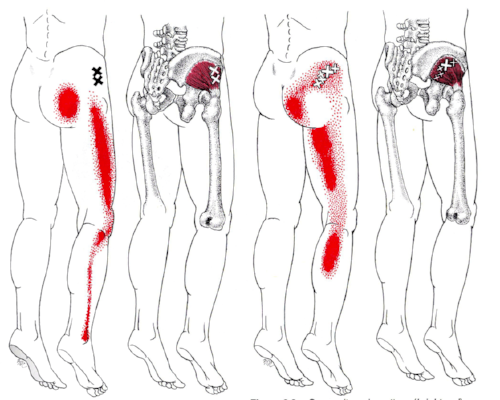 http://www.yoganatomy.com/wp-content/uploads/2011/10/glutmin_tps.png
