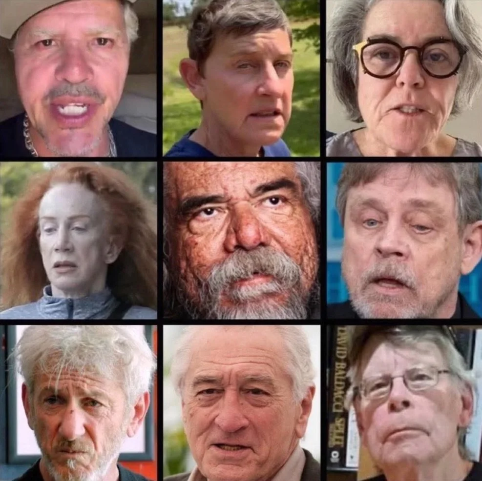 HOLLYWEIRDO HAS FULL BLOWN STAGE 4 TDS AND IT AINT PRETTY 🤮🤮🤮