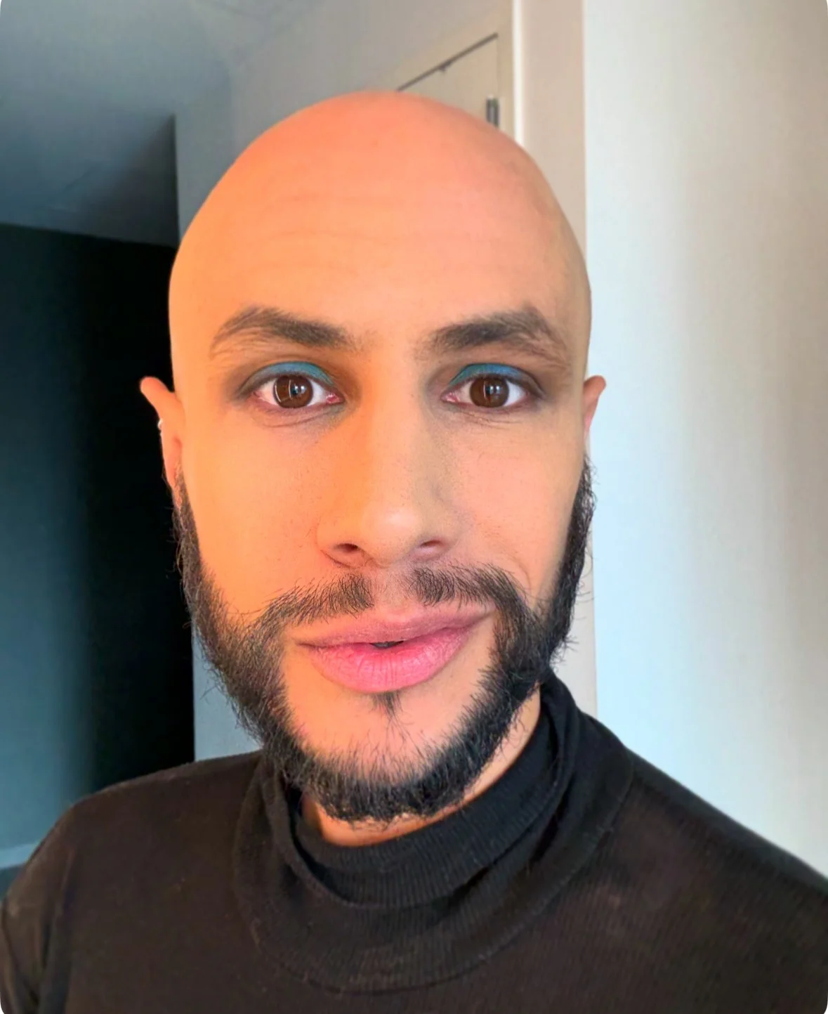 A Year After Surviving - Do I Really Have To?