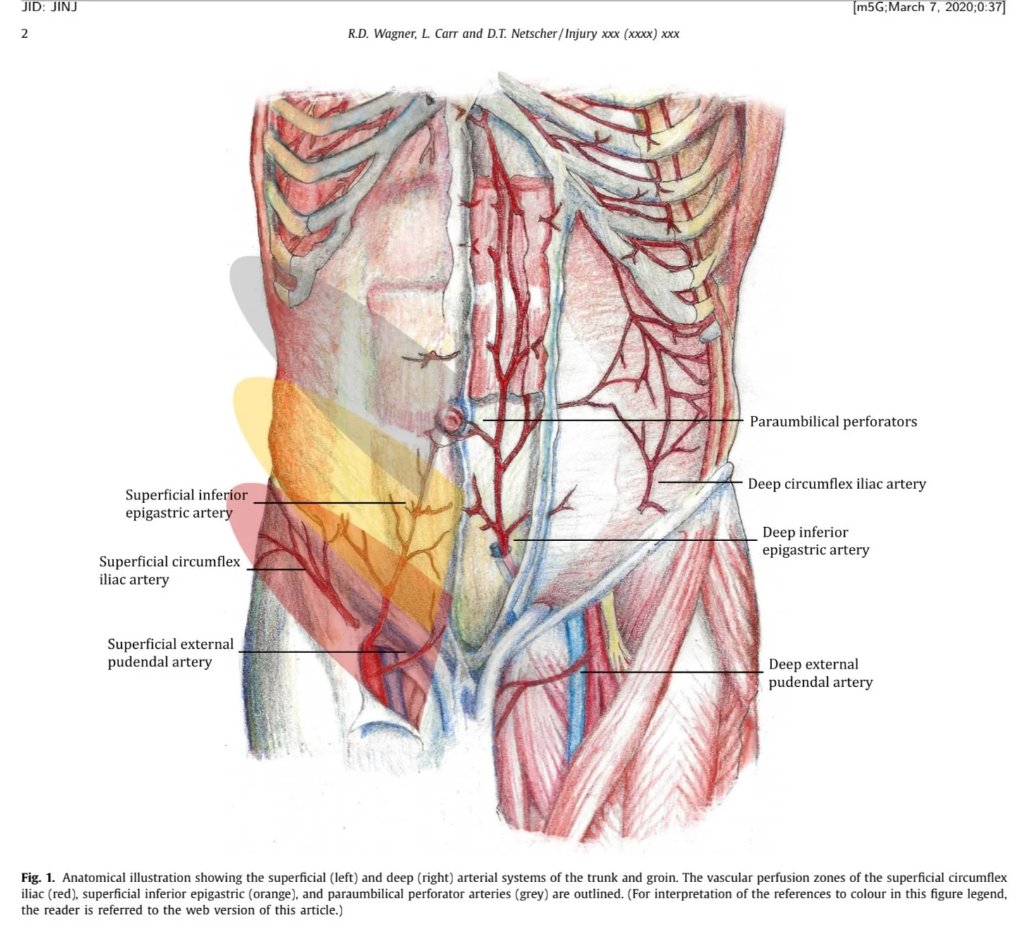  Wagner, R., L. Carr, and D. Netscher. “Current indications for abdominal-based flaps in hand and forearm reconstruction.” Injury, vol. 51, no. 12, 2020. 