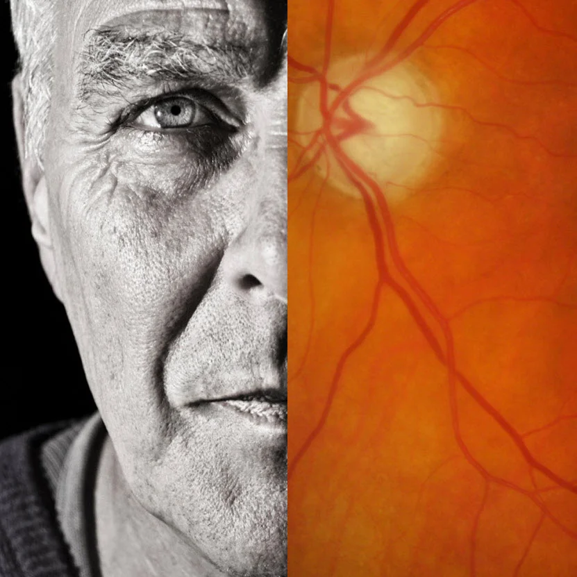 Bay Eye Care — and Retinal Disease