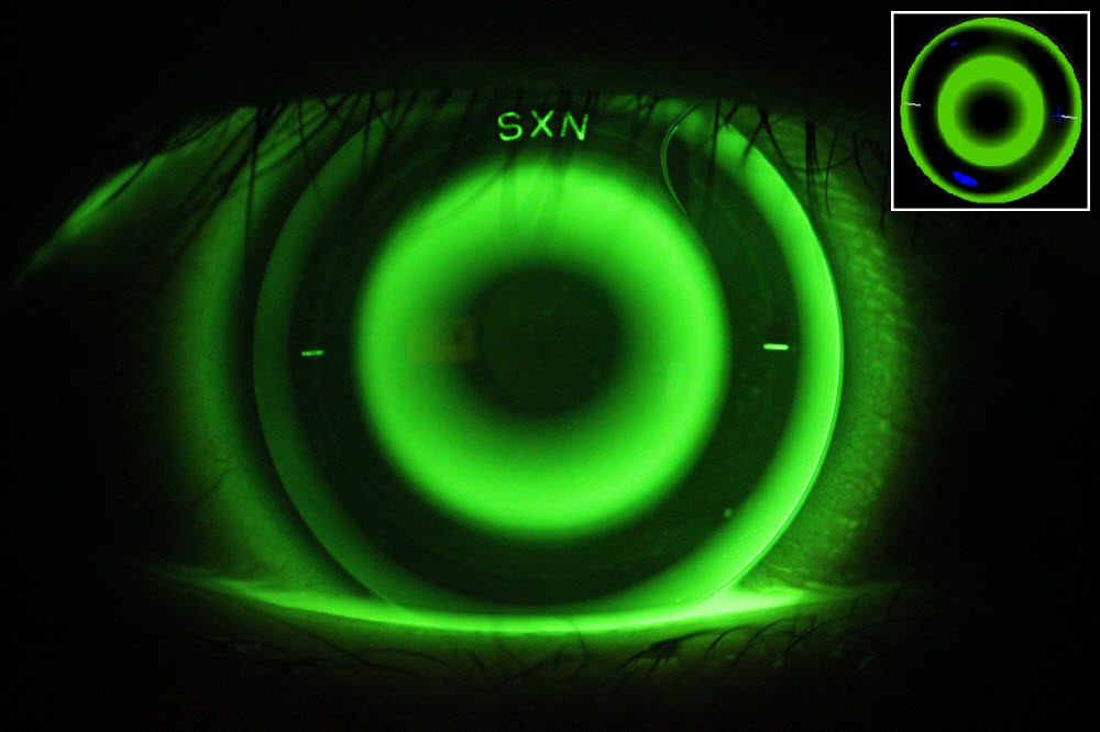 Bay Eye Care — Technology at Bay Eye Care