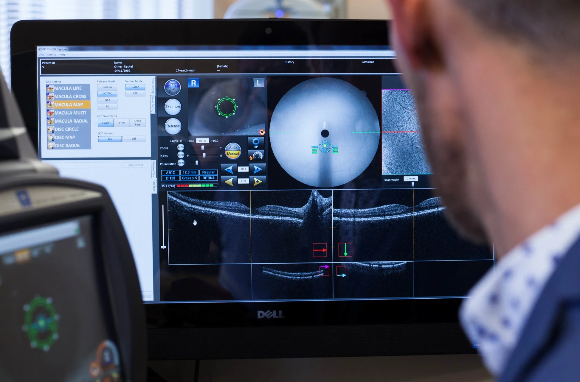 Alex examining the OCT scan of a patient's retina.