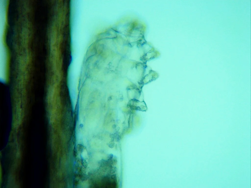 A demodex mite from on of our patient's eyelashes seen under the microscope.