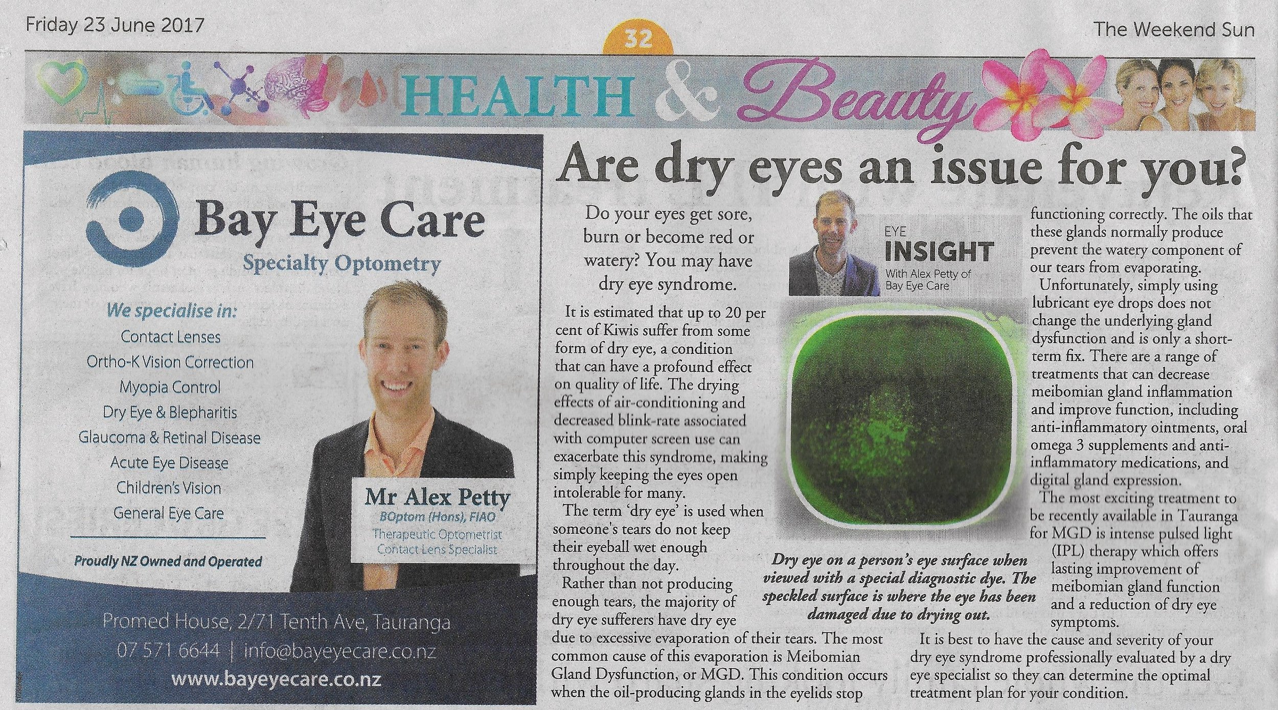 Dry Eye Treatments are discussed in the Weekend Sun June 2017