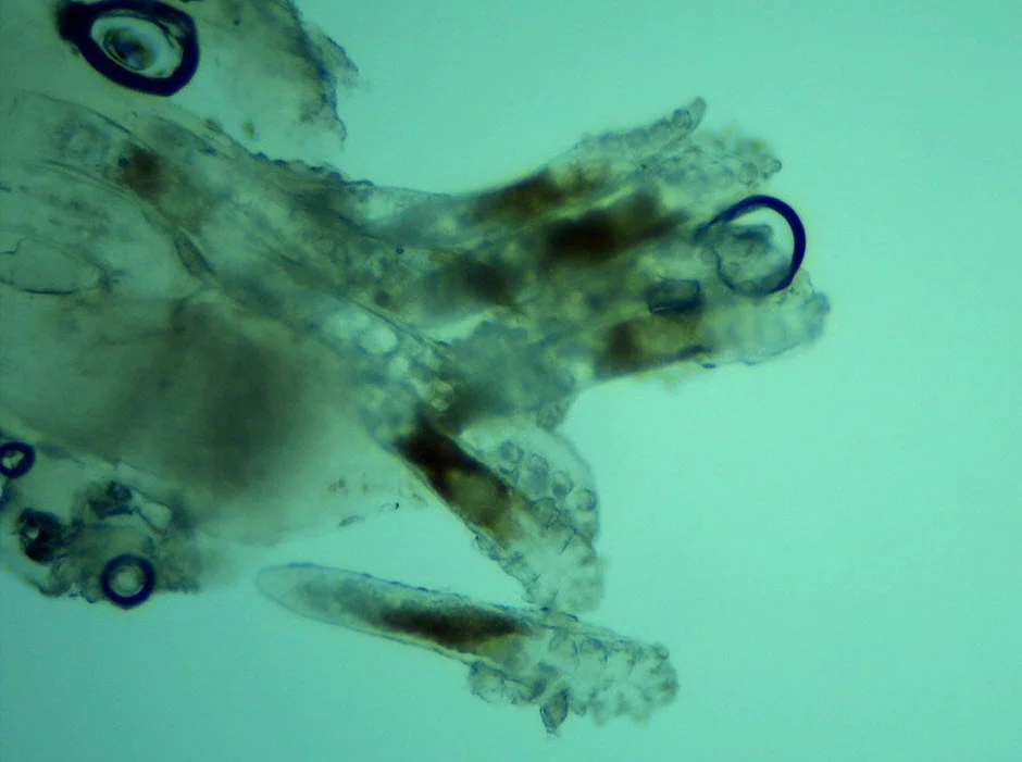 Numerous demodex mites infesting an eyelash of someone with anterior blepharitis