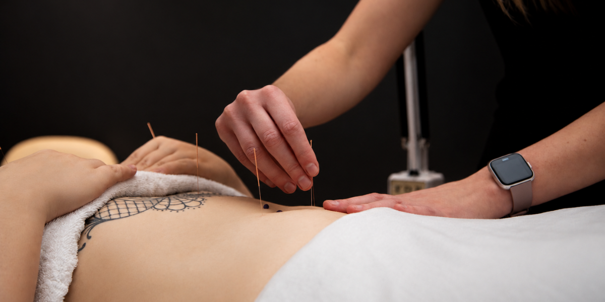 _Acupuncture 4.png