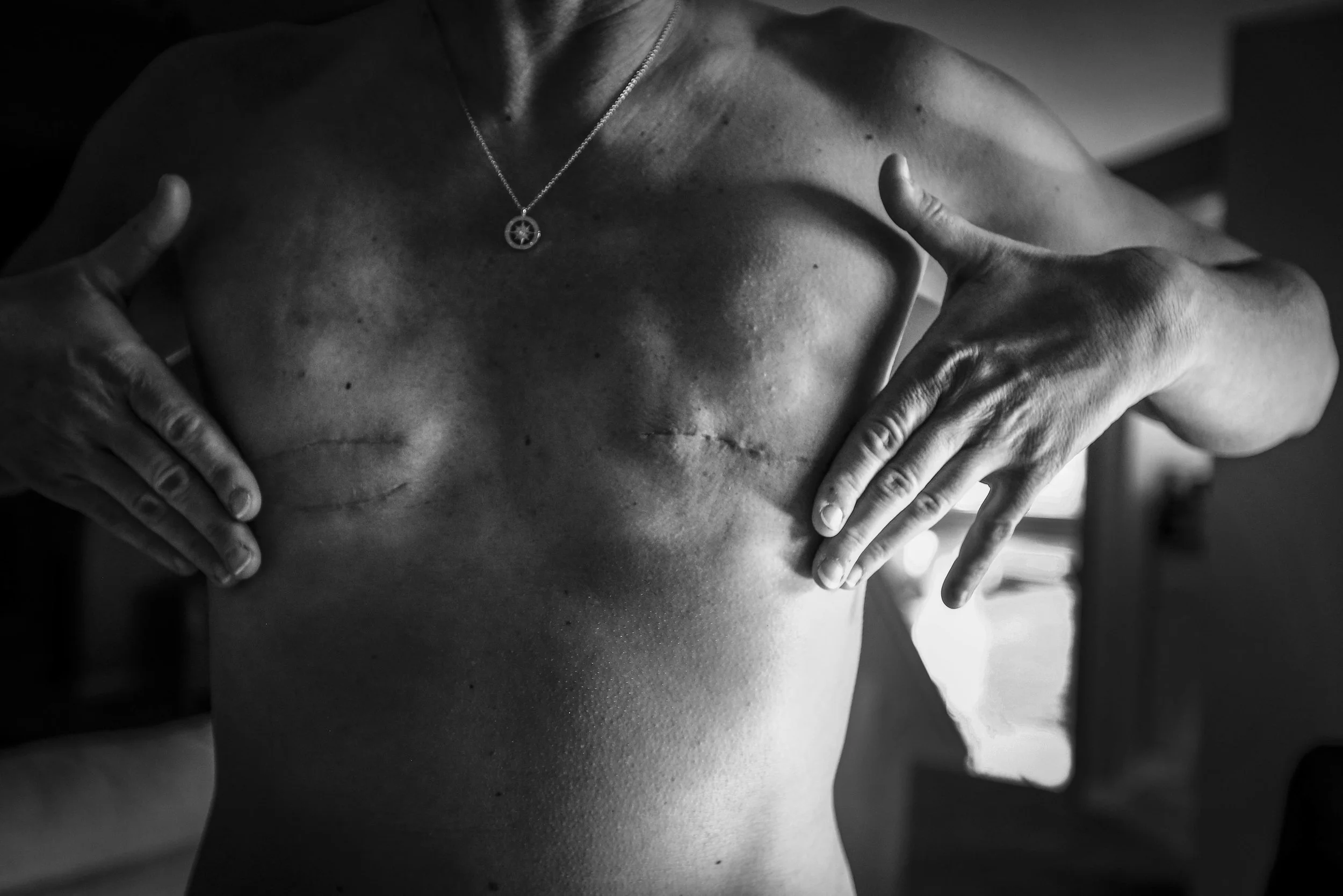  "I have a voice. I have always had a voice," said Melanie Howe while gently touching her scars along her body, March 19, in her Muncie condo. Melanie is a marketing analysis helping small Muncie businesses with navigating marketing and social media 