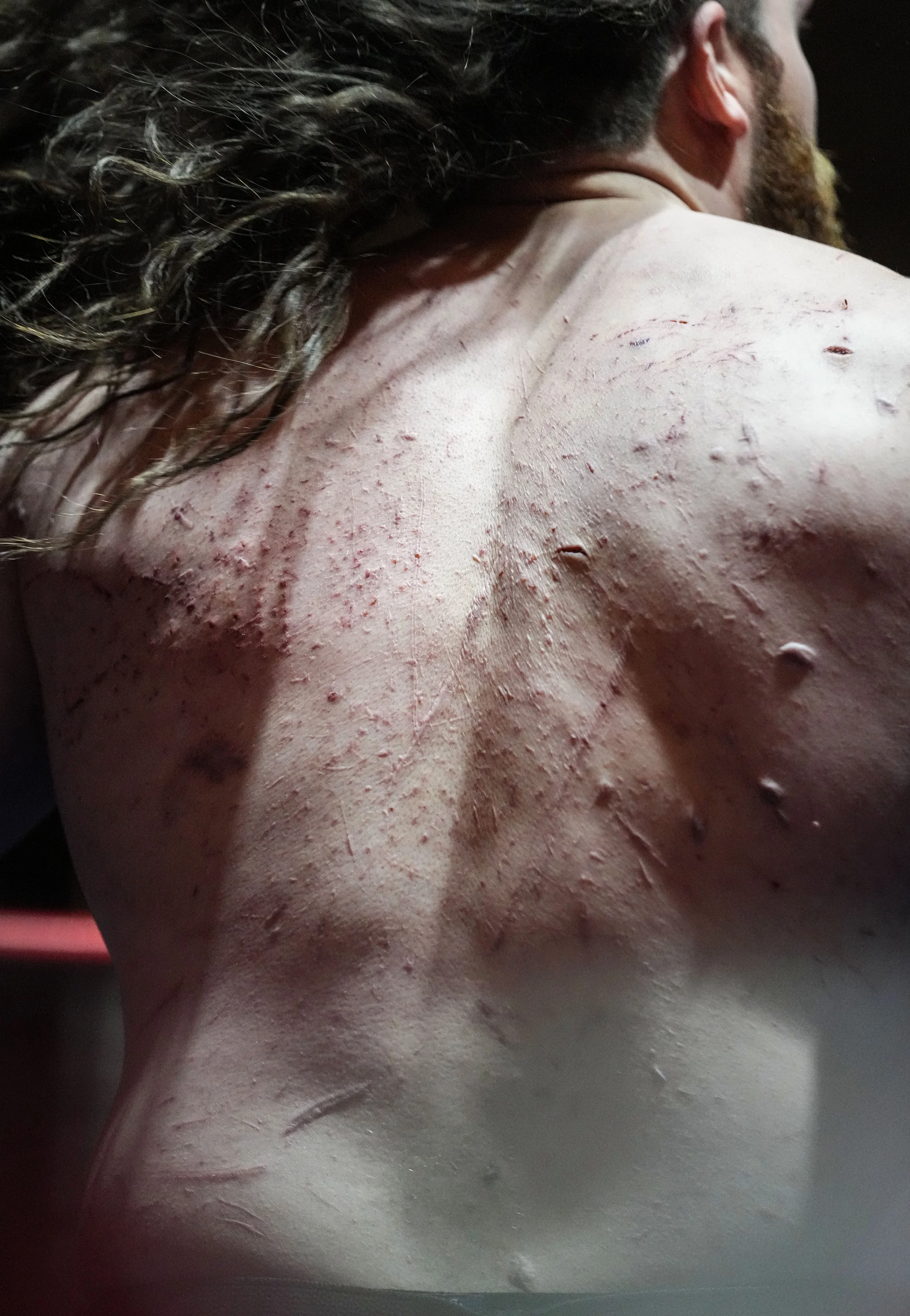  Scars are seen on the back of Remington Roy as he walks around the ring during a Flophouse Wrestling show on Sunday, March 20, 2022, at Indiana City Brewery in Indianapolis. Roy's scars are from previous death match shows. 