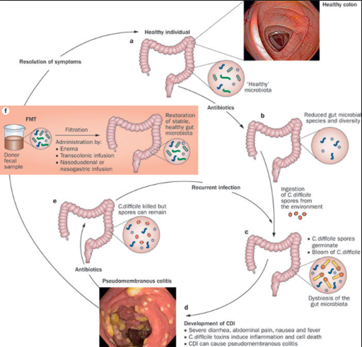 http://www.nature.com/articles/nrgastro.2011.244