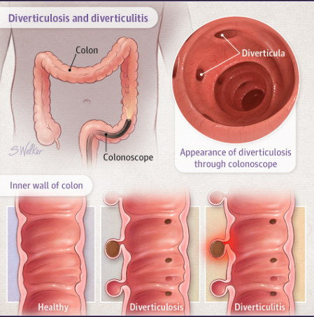 adapted from JAMA