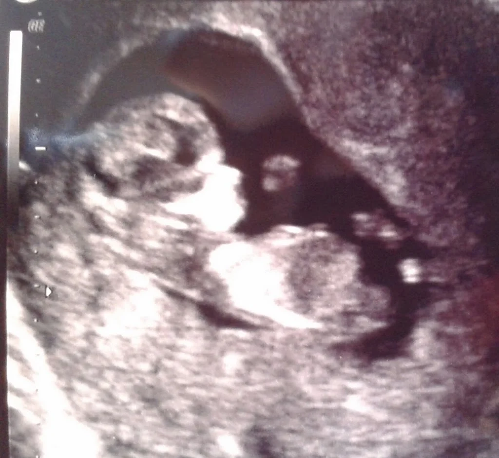 serena-sonogram.jpg