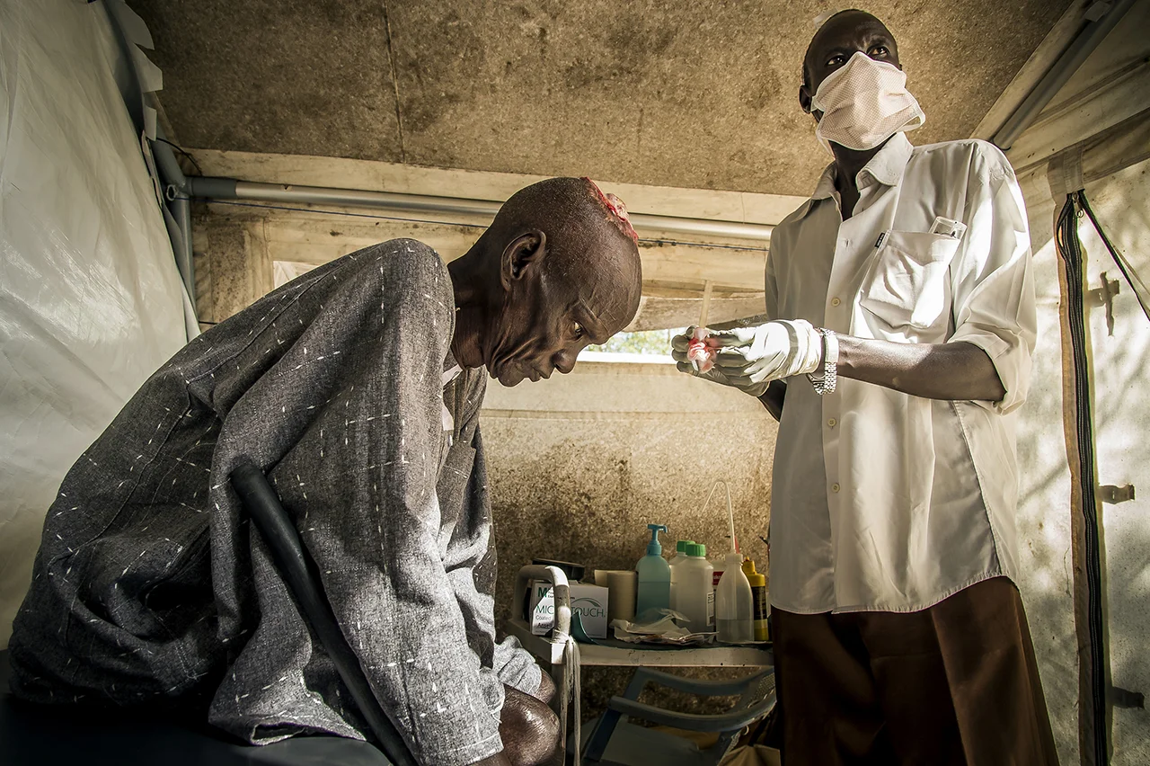 This old man has a festering hole in the head for 3 years. He come to have his wound cleaned and his bandage renew every three days, for a year at the Old Fangak clinic. He has never suffered injury or trauma. May be a carcinoma, a cancer ... There is nothing to do other than to cure the symptom.