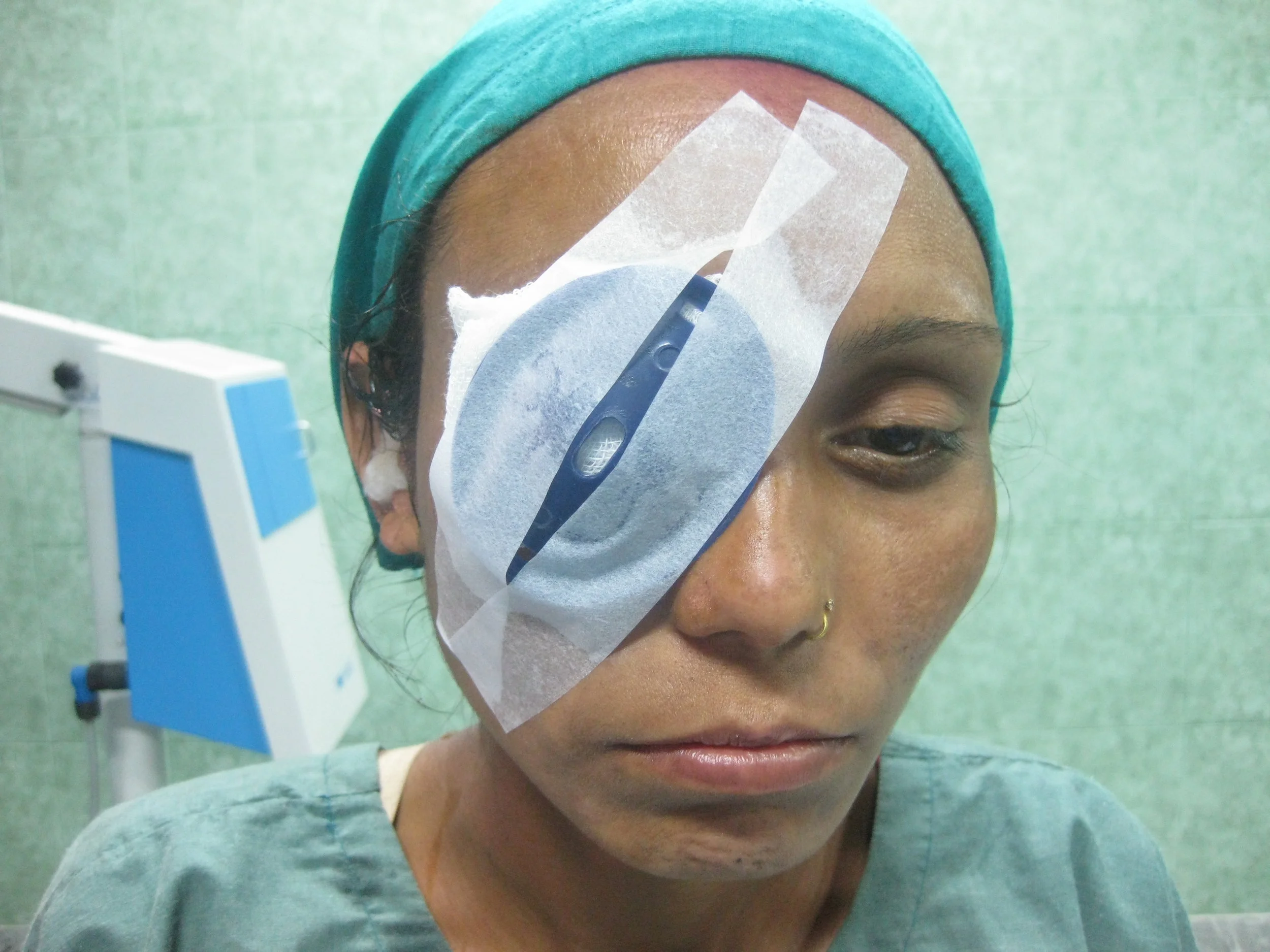 Immediately after surgery.JPG