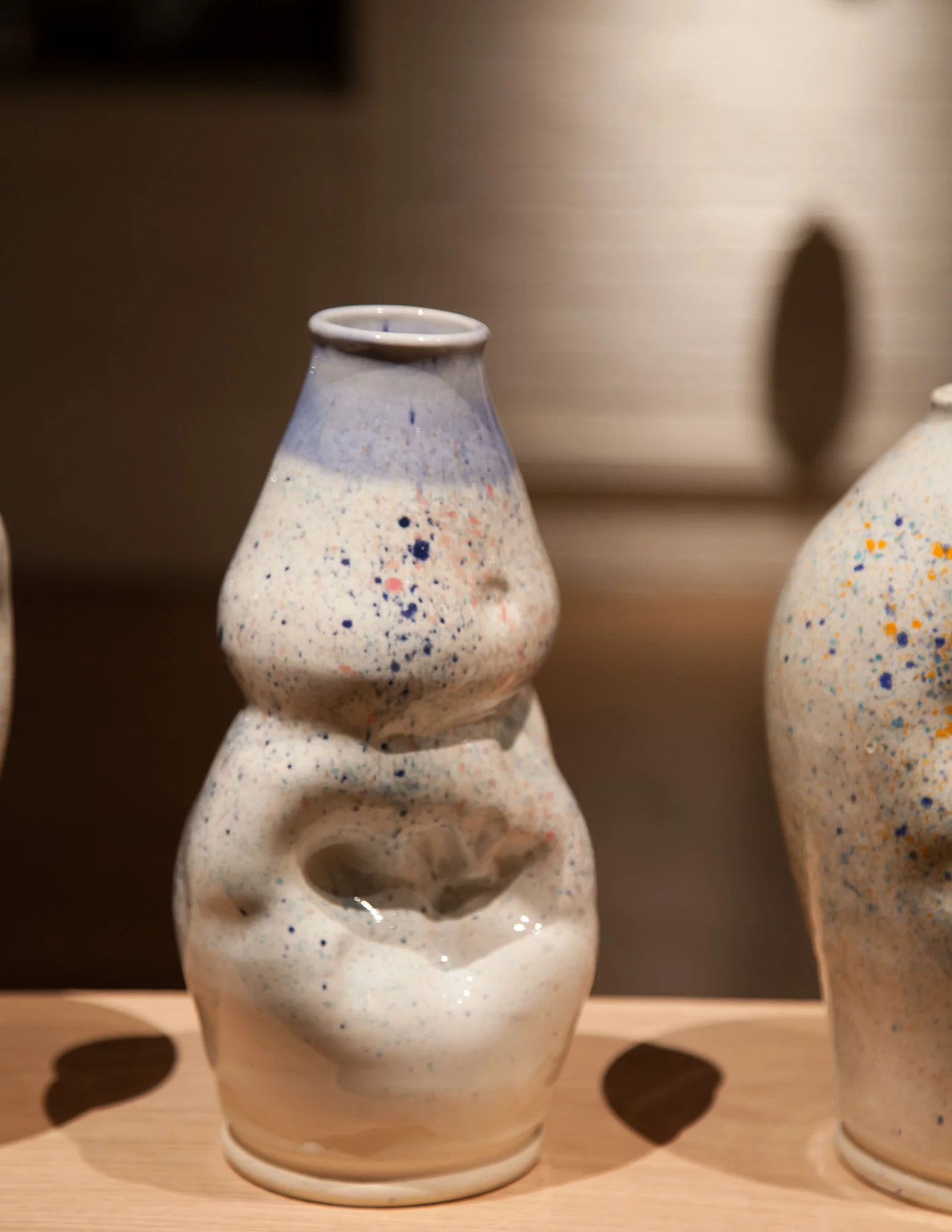 Too heavy but otherwise solid execution of second round of spritz with unnecessary rim distraction 1