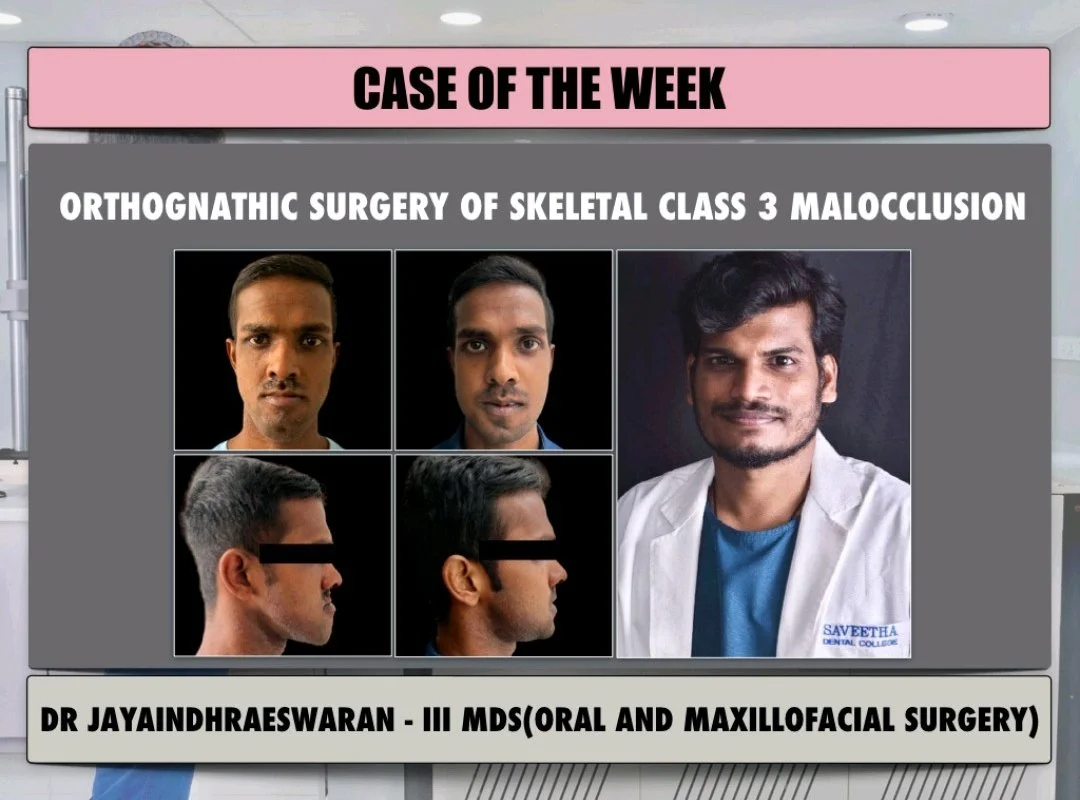 Best Case of the Week: Skeletal Class III Malocclusion Correction