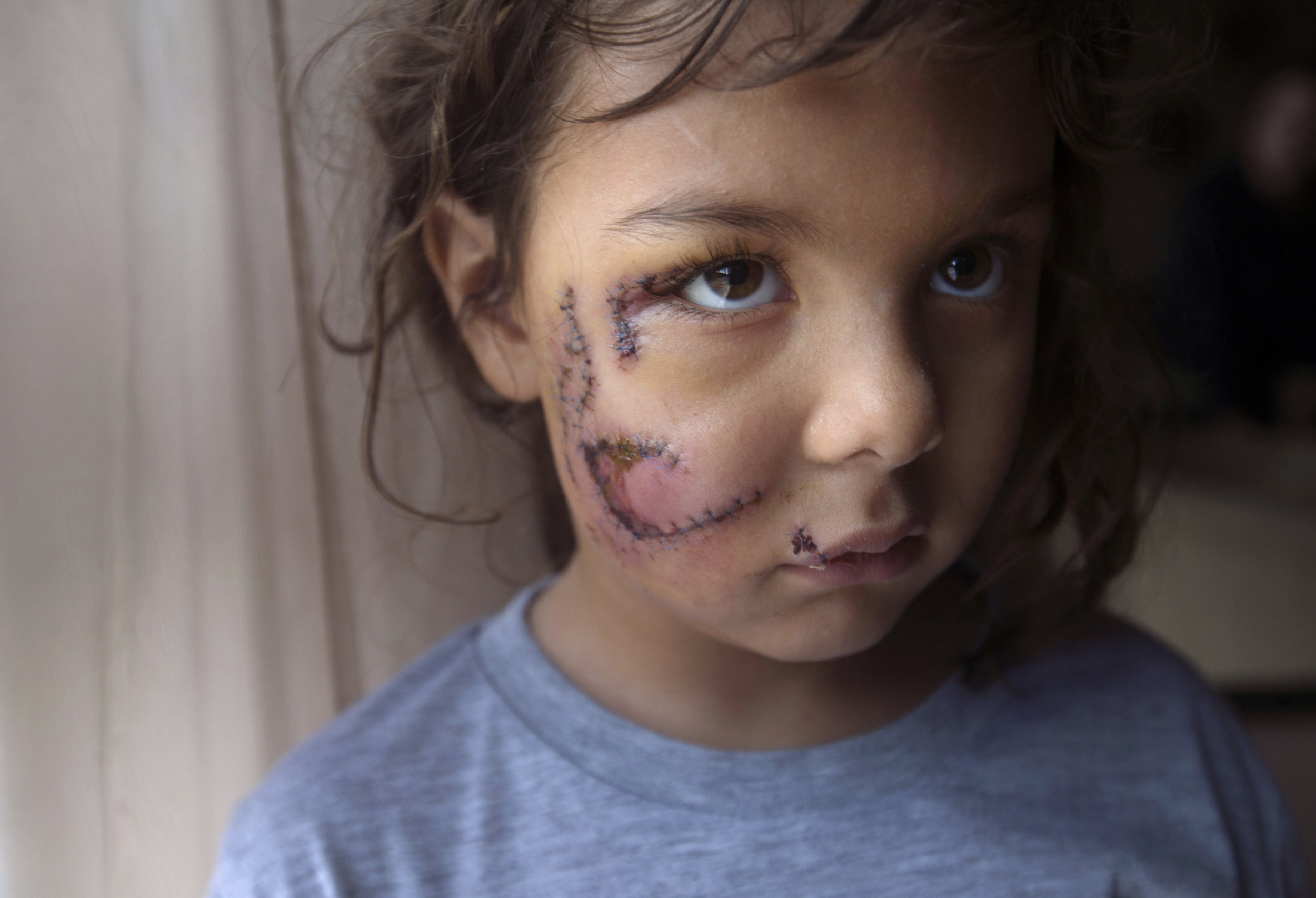 Photojournalist of the Year 2018