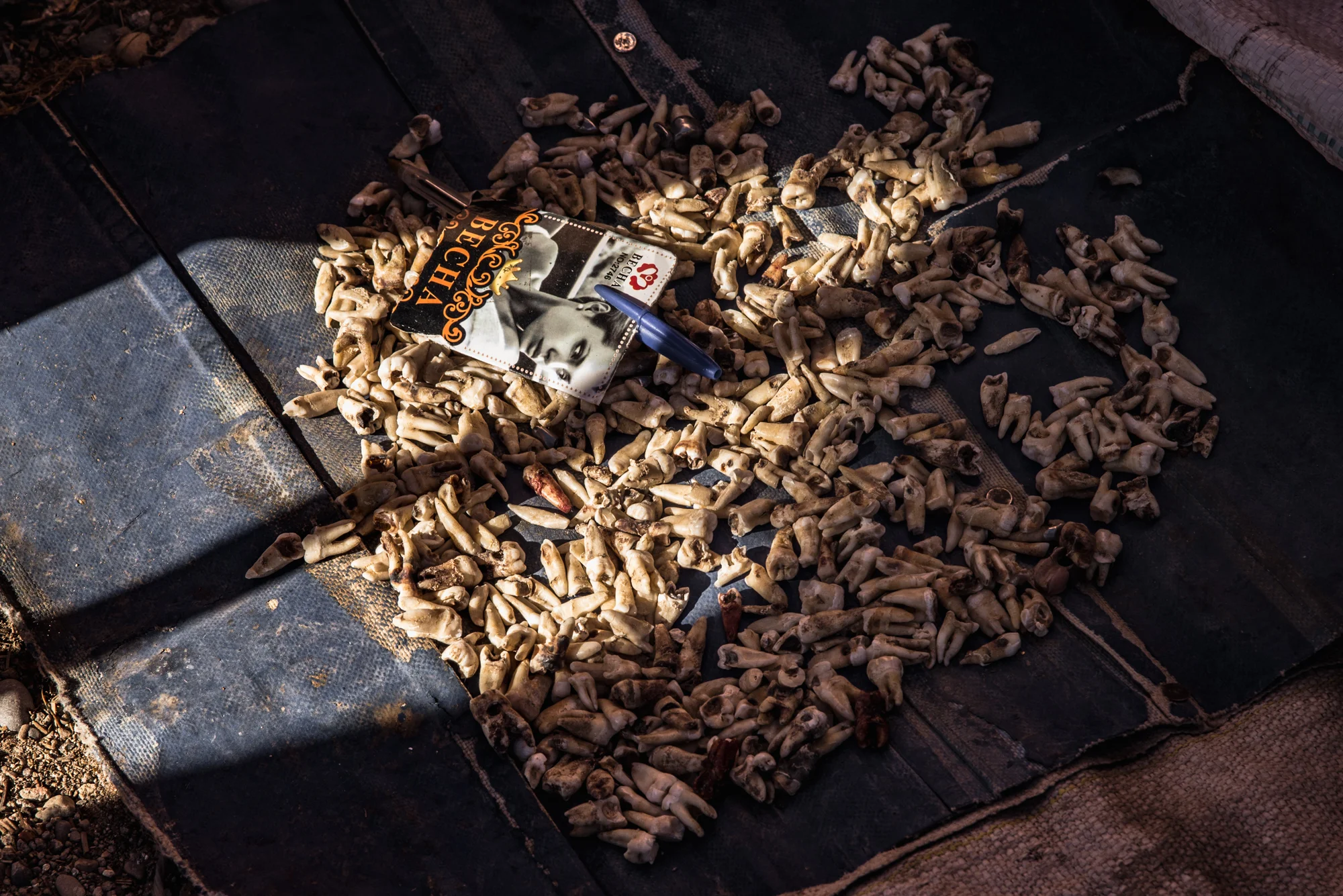 Man advertising his teeth-pulling business at a local market