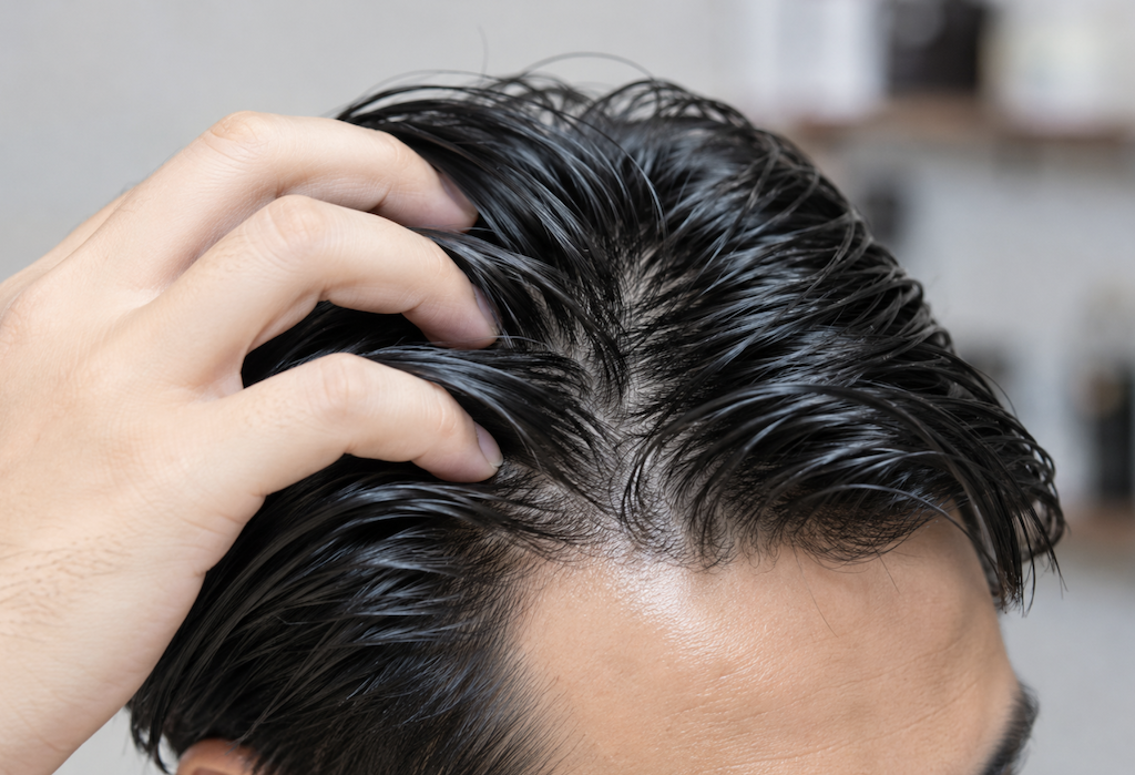 Reasons for oily hair in men