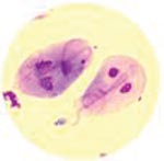 is giardia found in well water