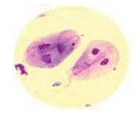 Giardia