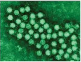 Virus Coxsackie B