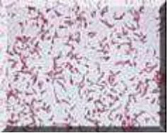 Campylobacter détaillé