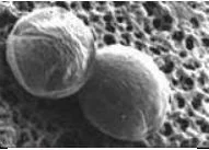 Cryptosporidium détaillé