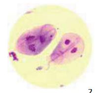 Giardia détaillé