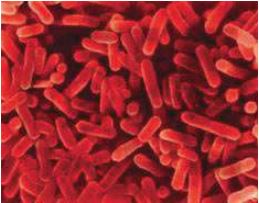 Legionella détaillée