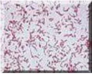 Mitoni Ācimostakewin Campylobacter