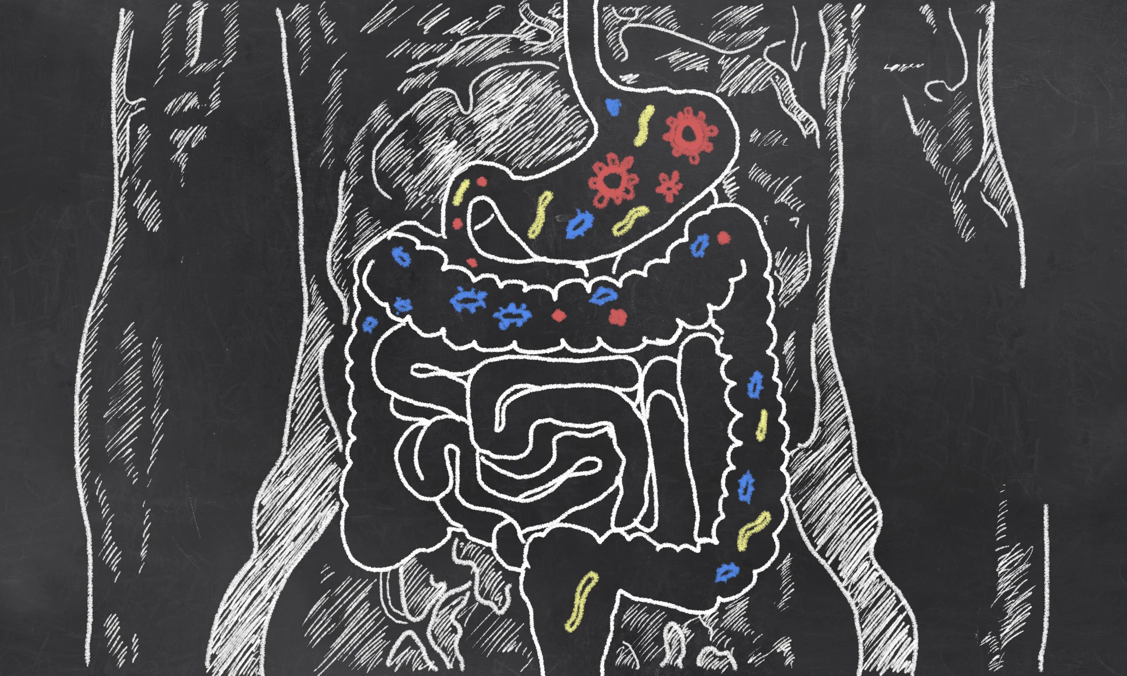 Leaky Gut, the Syndrome You Didn't Know You Have