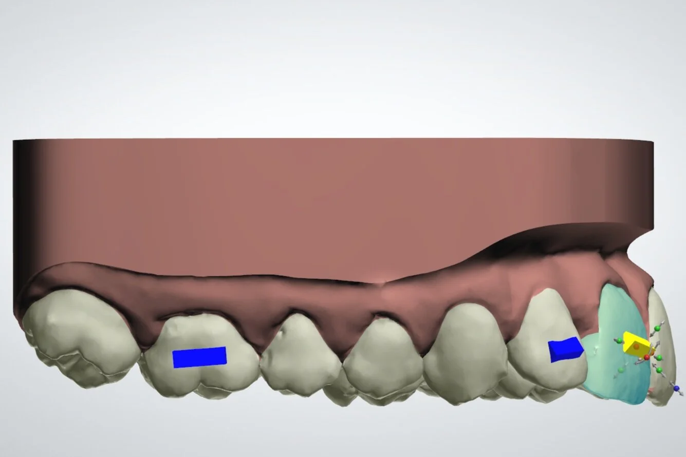 orthodontics - SDC