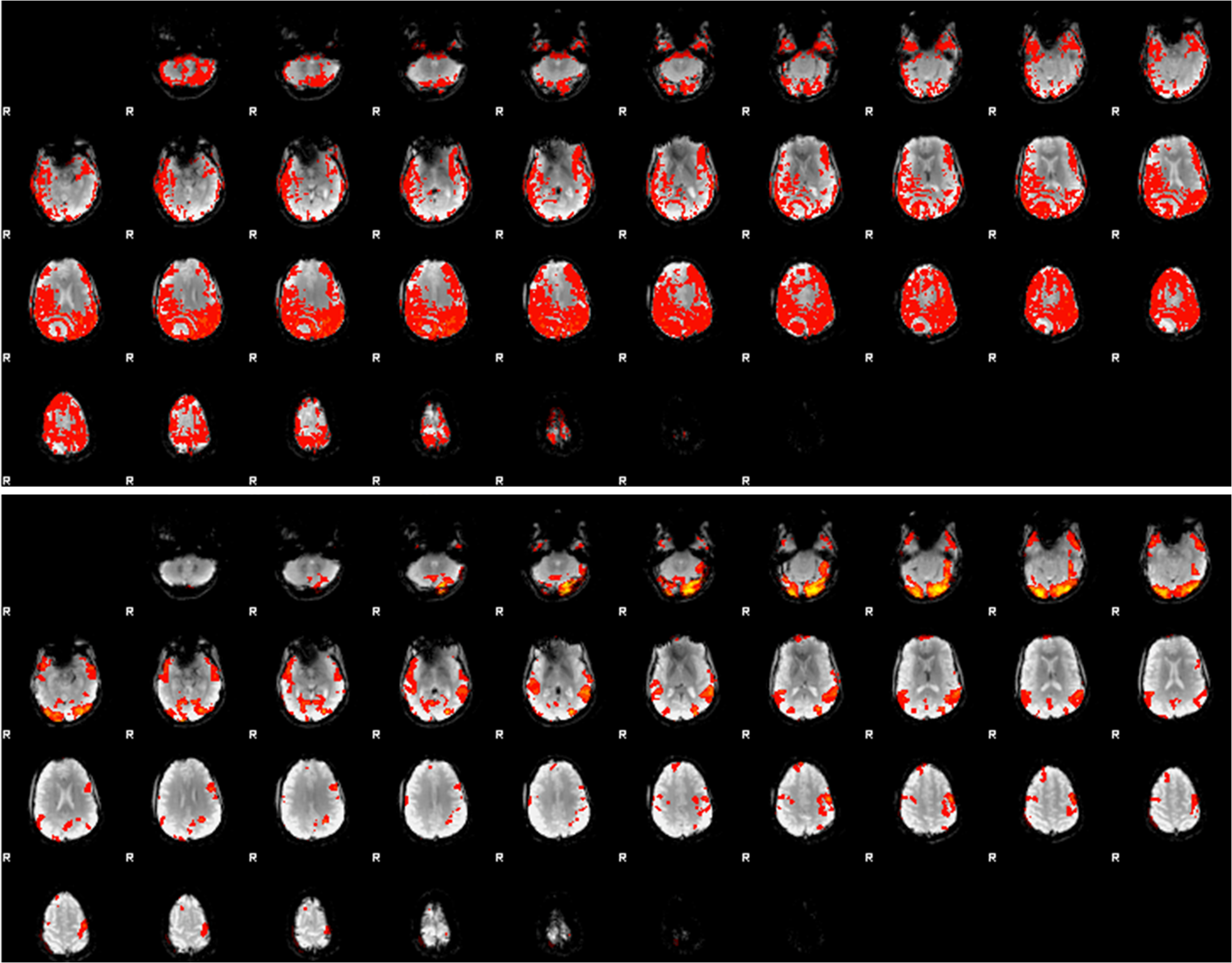 Representative data showing differences in blood flow between reading conditions
