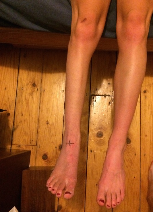 My right leg after 18 weeks no weight bearing.