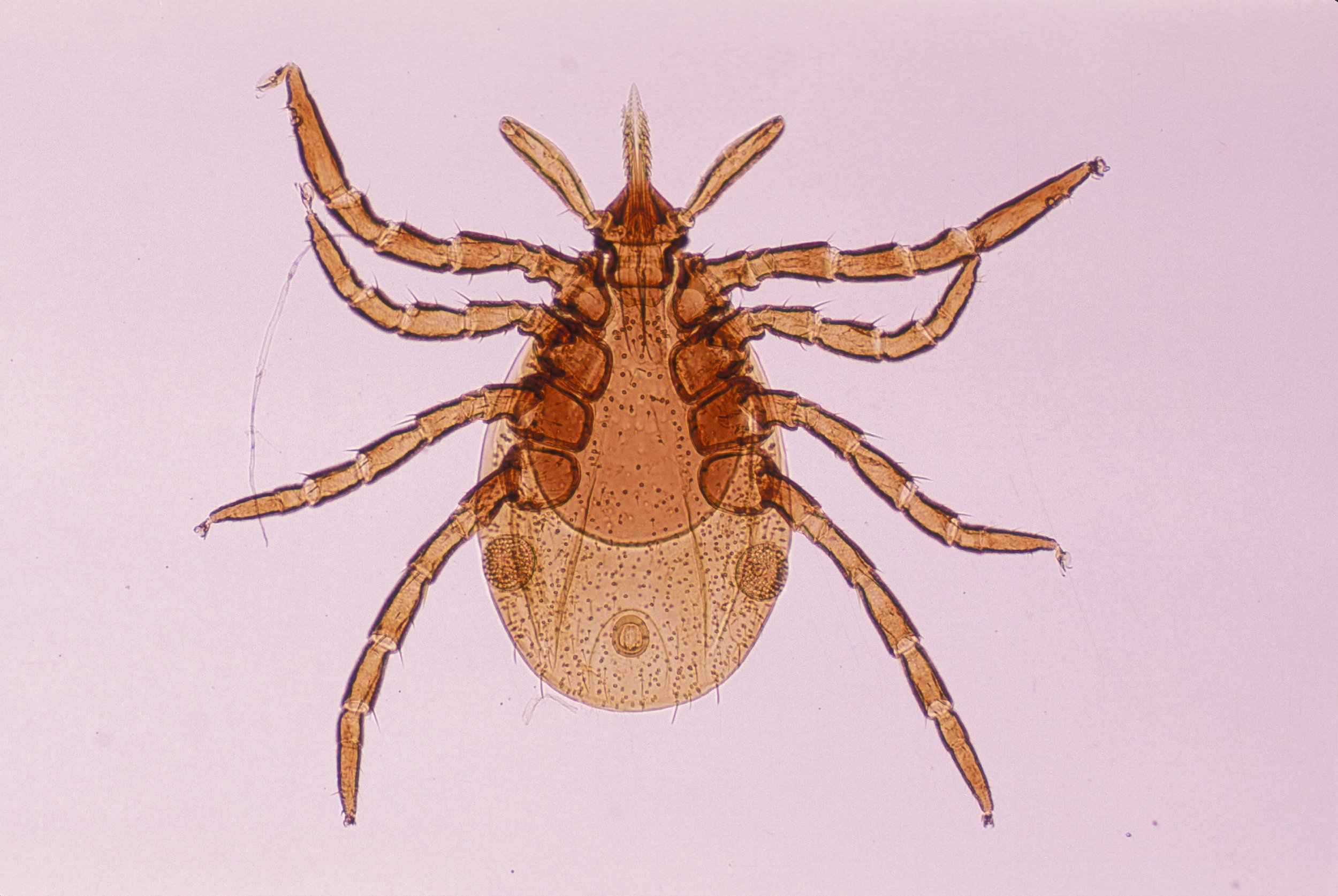 deer-tick-nymph-ixodes-dammini-vector-of-lyme-royalty-free-image-1589220632.jpg