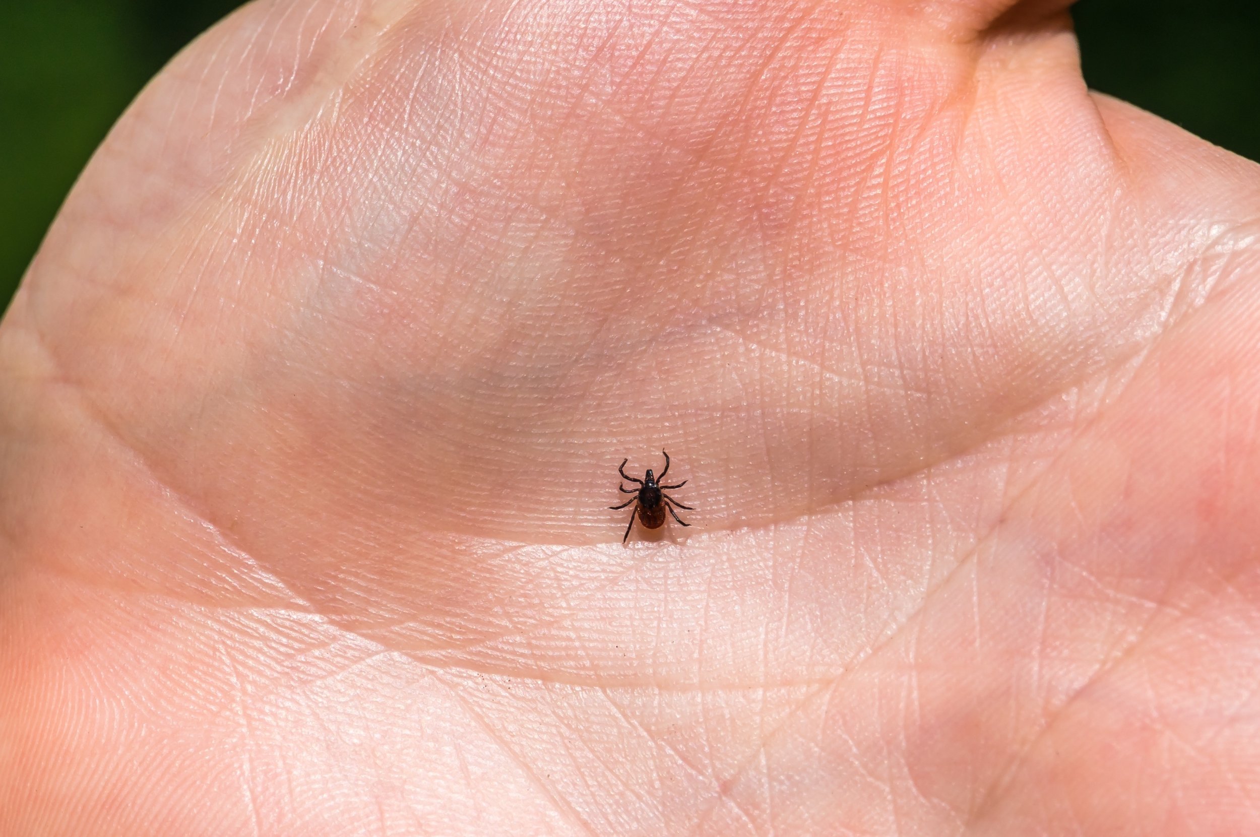 lyme-disease-deep-tick-shutterstock.jpg