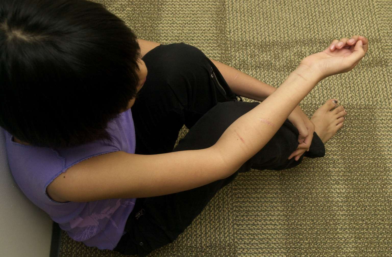 Self-Harm in Children and Young People