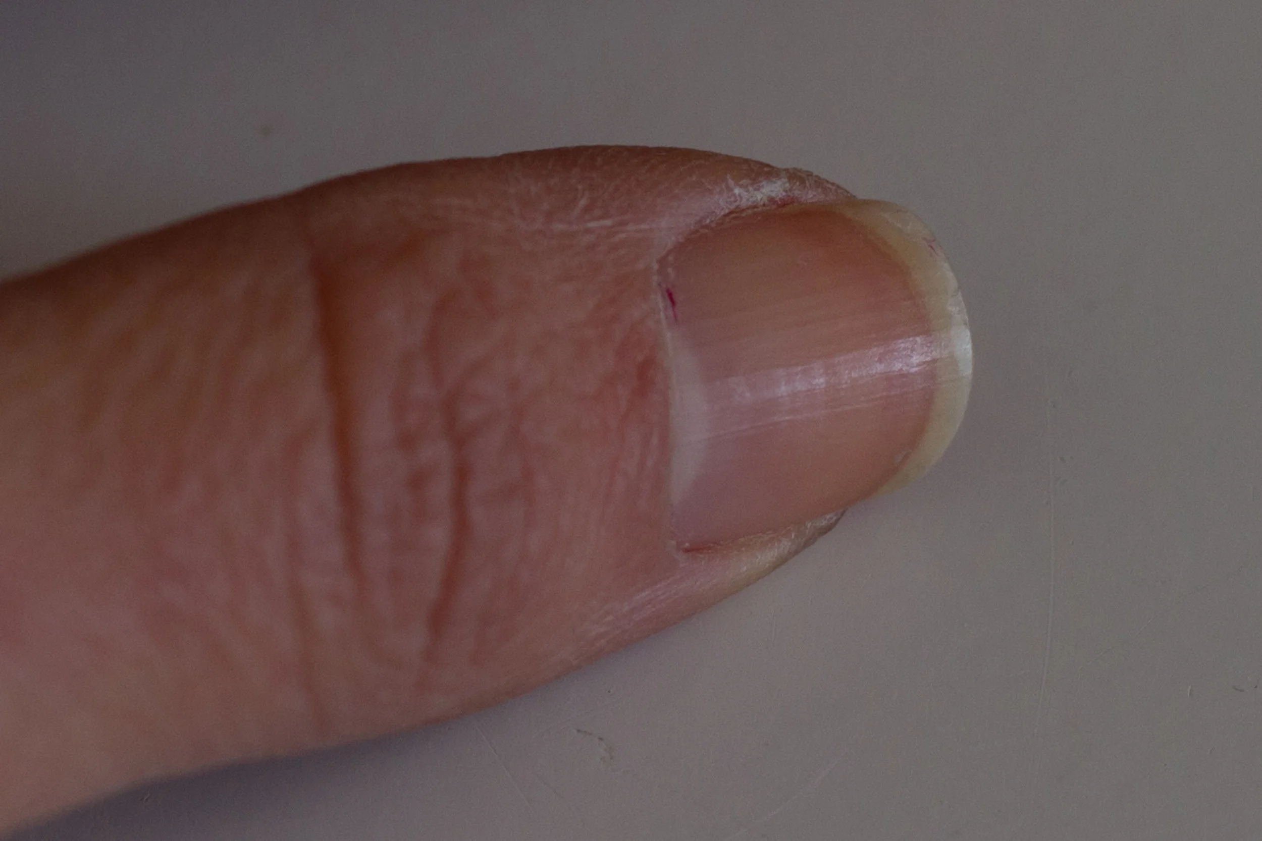 At a lower ISO the nail looks crisp, although darker because the camera is less sensitive. (ISO 200, f /3.5, 1/50 seconds)