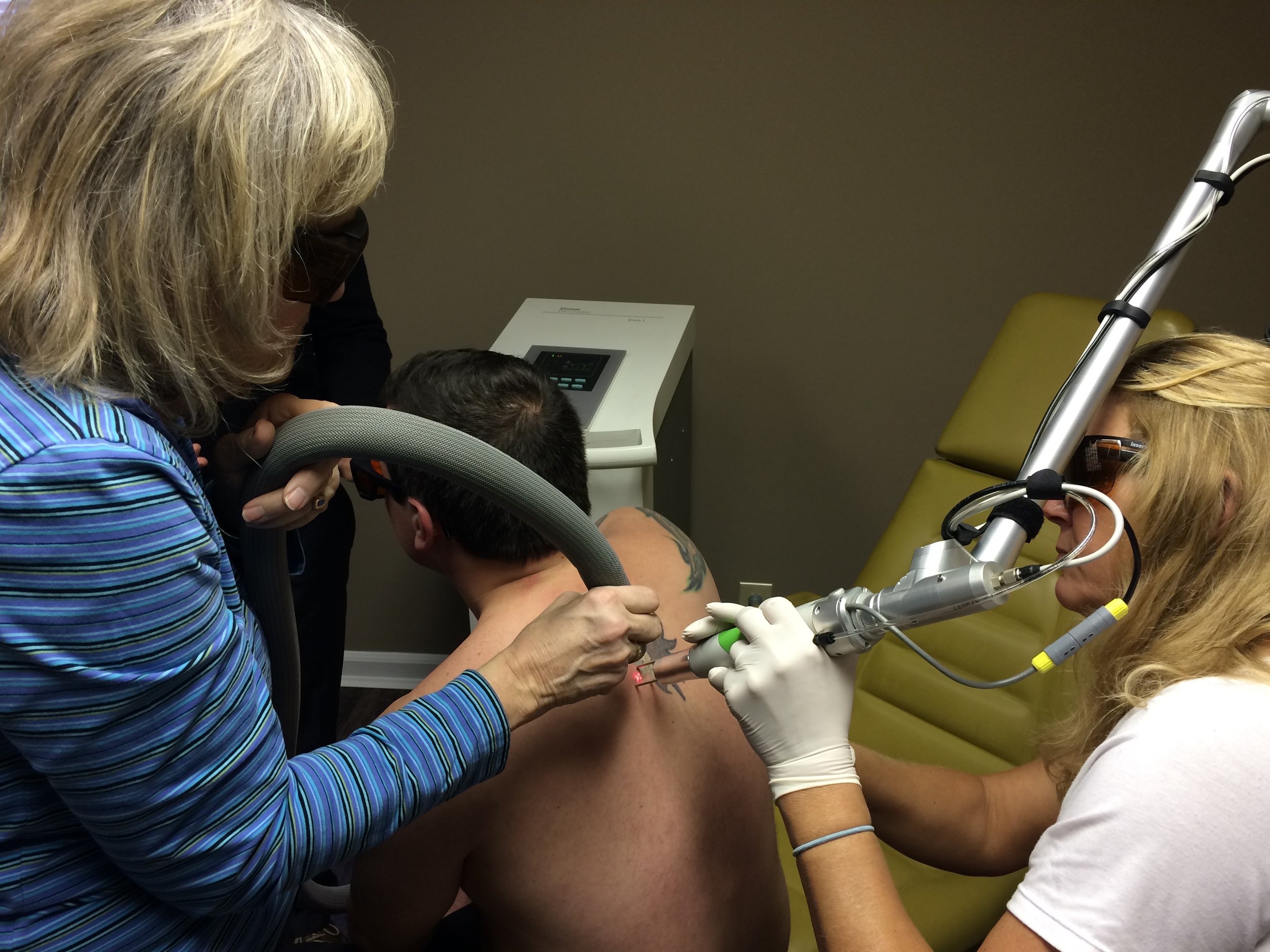 Removing a tattoo from a volunteer client's back