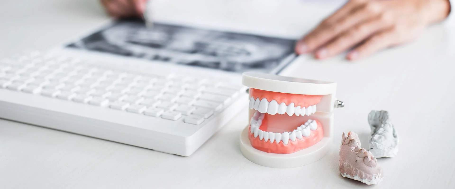 Dentures-Partials-Olathe-Dental-Care-Center-slide.jpg