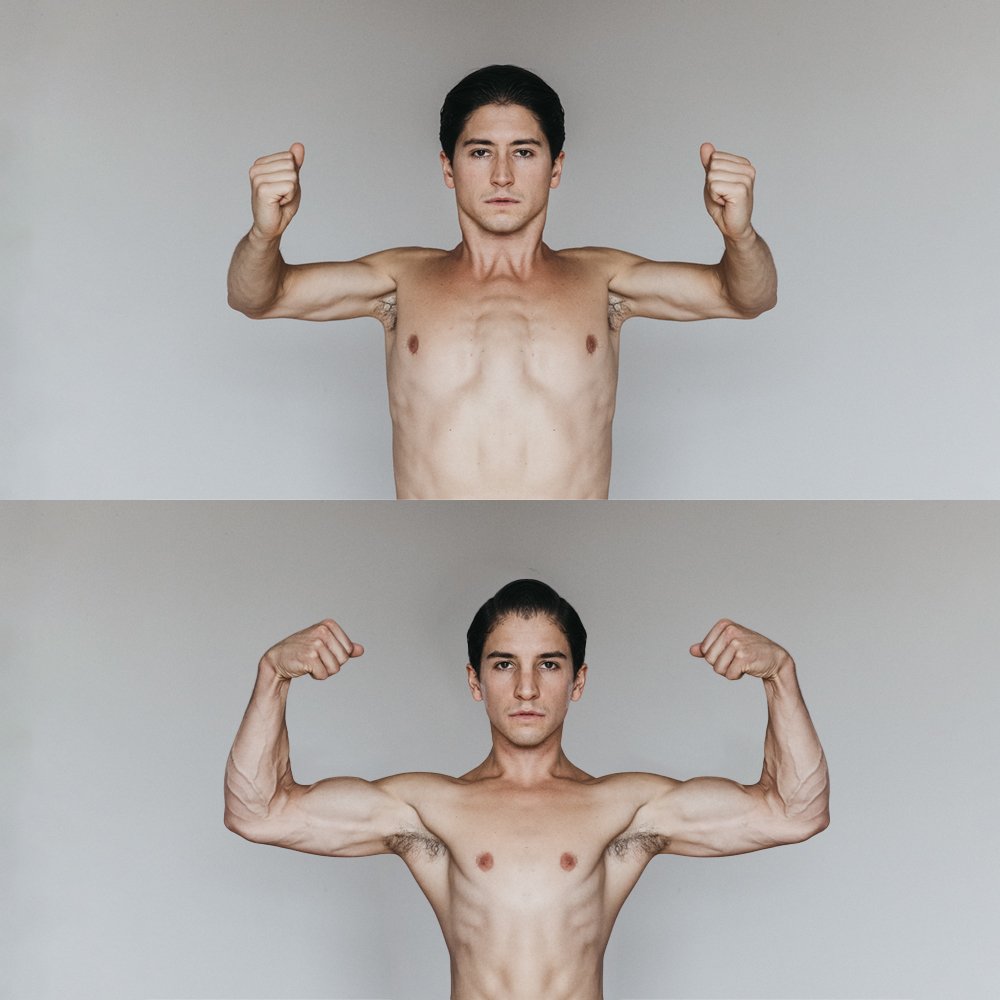 My Path to Self-Acceptance: Recognizing the Beauty of Asymmetry